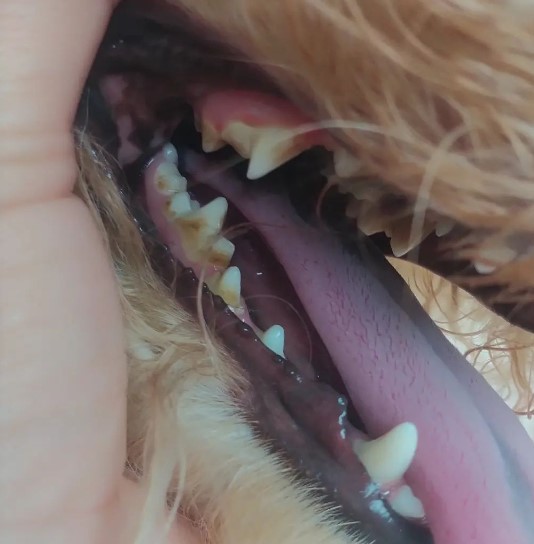 Dental Deep Cleaning